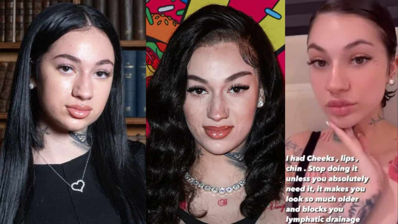 Bhad Bhabie Dissolved Her Fillers